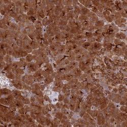 ECM29 Antibody, Novus Biologicals 25ul | Buy Online | Novus Biologicals | Fisher Scientific